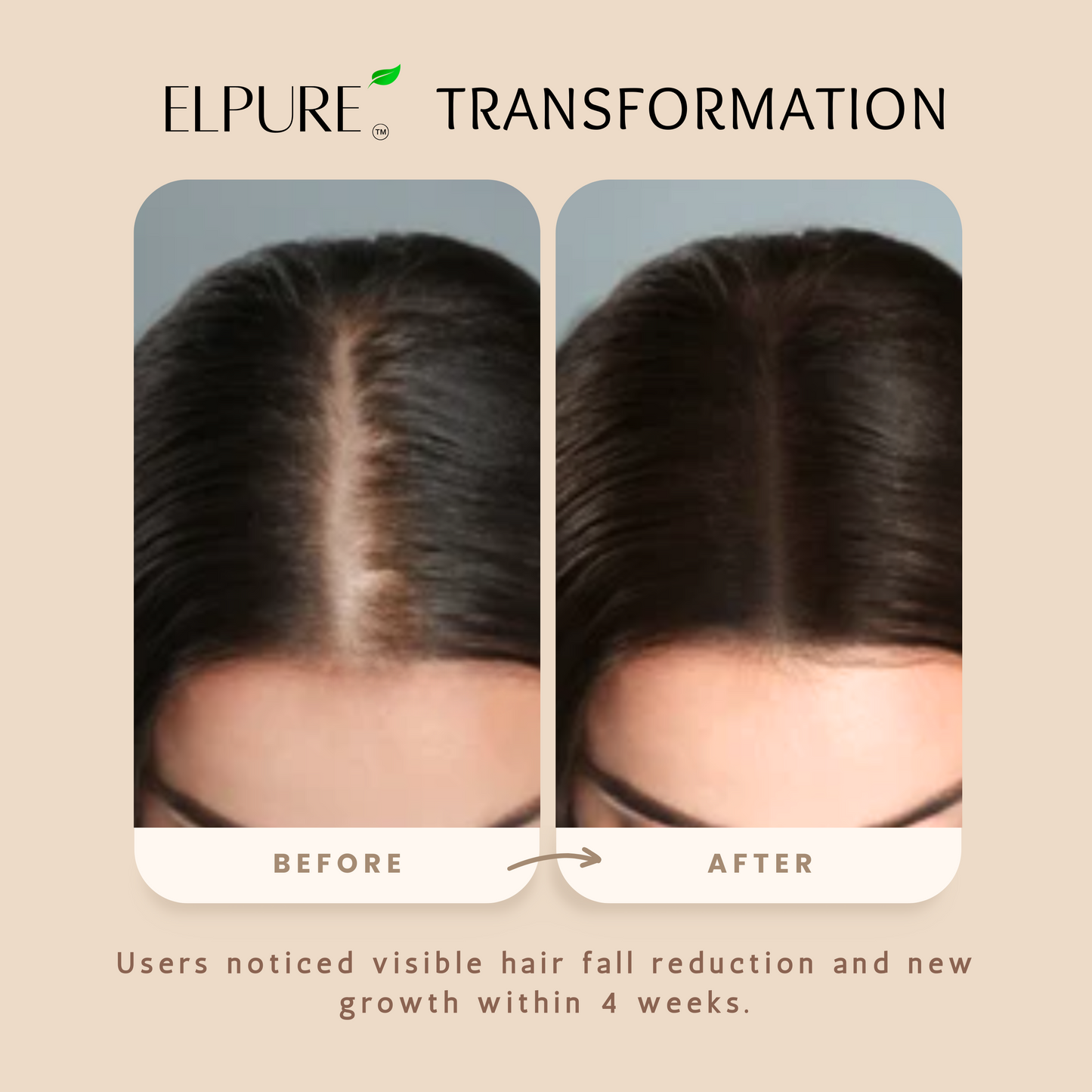 Premium Hairfall Solution Oil | Export Quality | 100% Cold Pressed Coconut, Castor, Almond Oils with Fenugreek & Onion Seeds | No Chemicals, No Preservatives